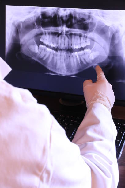 Best Emergency Wisdom Tooth Extraction in Clearview, WA